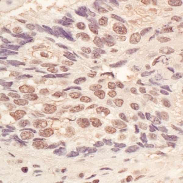 Polyclonal Rabbit anti-Human L3MBTL3 Antibody (aa550-600, IHC)