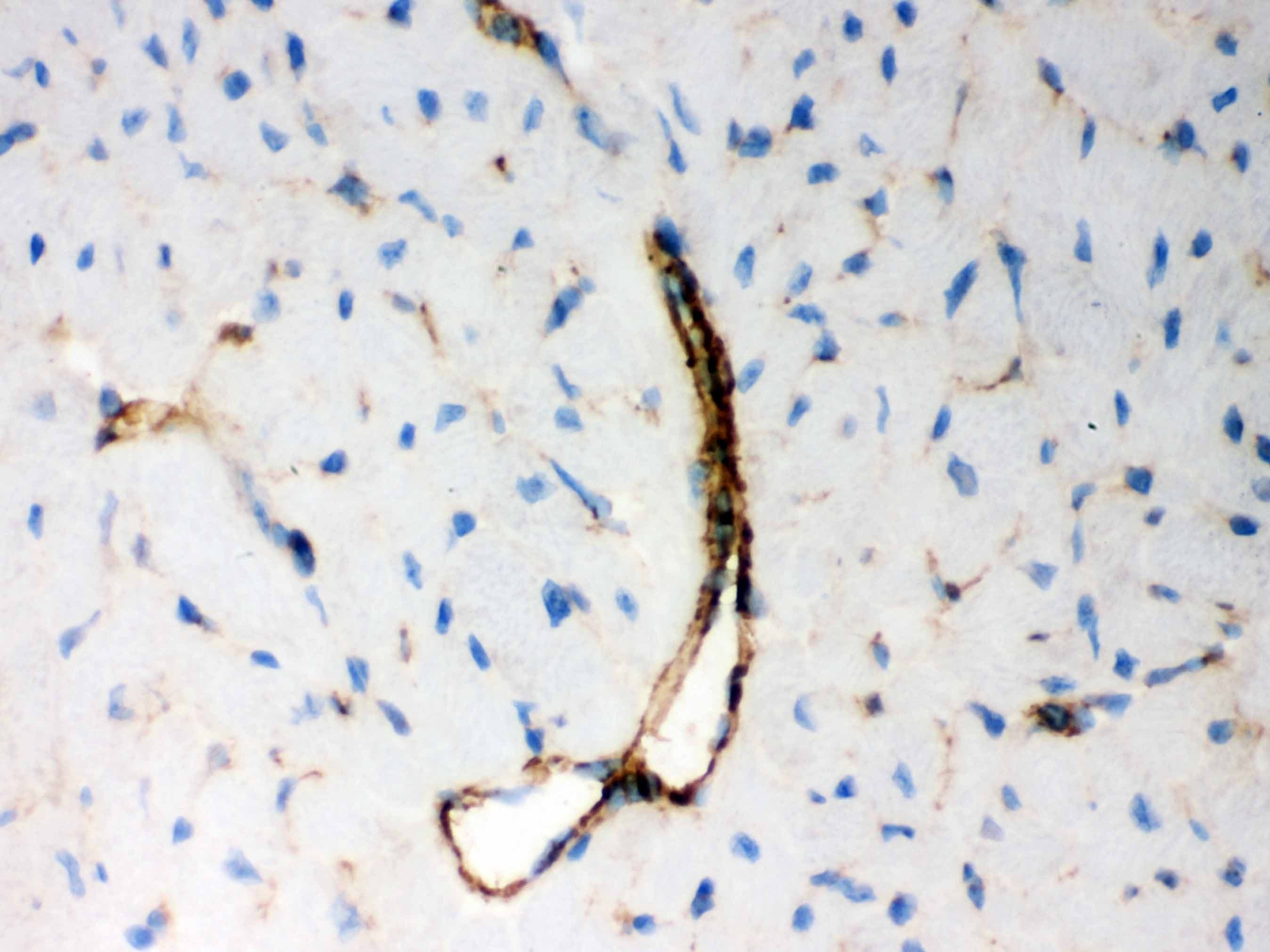 BAK1 / BAK Antibody (aa22-211)