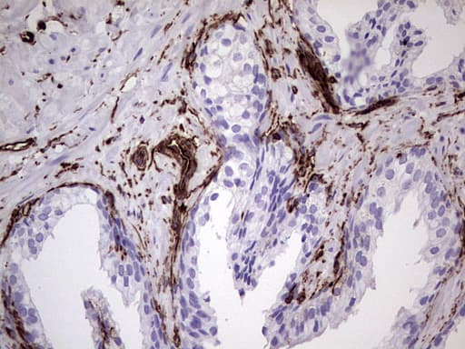Monoclonal Mouse anti-Human Vimentin Antibody (clone UMAB160, IHC, IF, WB)