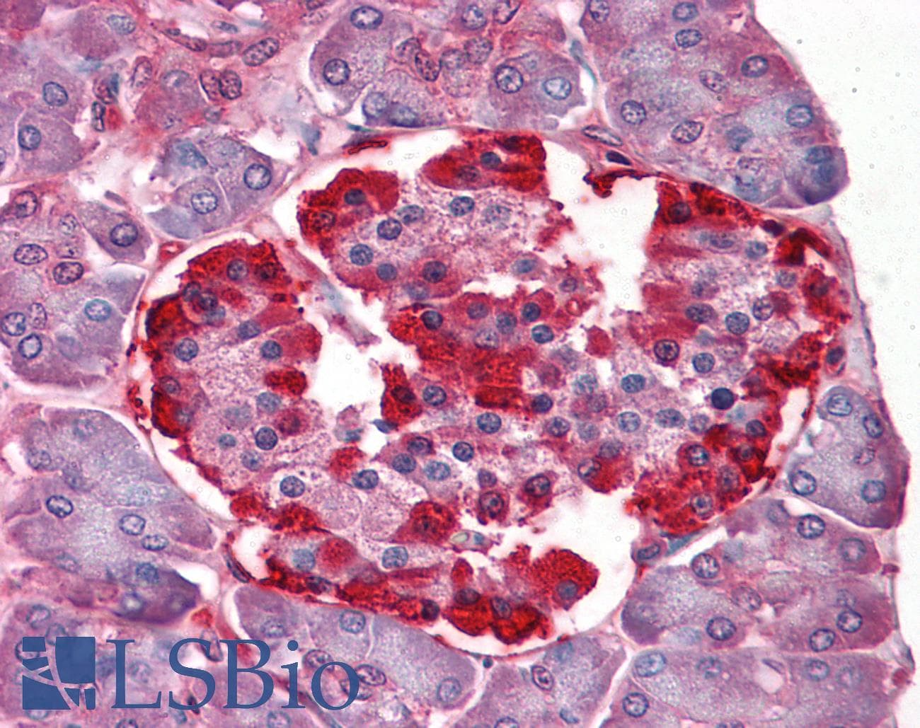 IHC-plus™ CLIC1 / NCC27 Antibody (clone 3F9)
