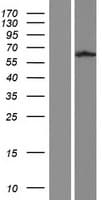 TUB / Tubby Protein (Over-Expression Lysate Myc-DDK (Flag))