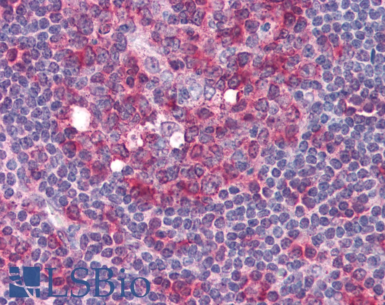 IHC-plus™ Monoclonal Mouse anti-Human TUBA1 / Tubulin Alpha 1 Antibody (N-Terminus, IHC, IF, WB)