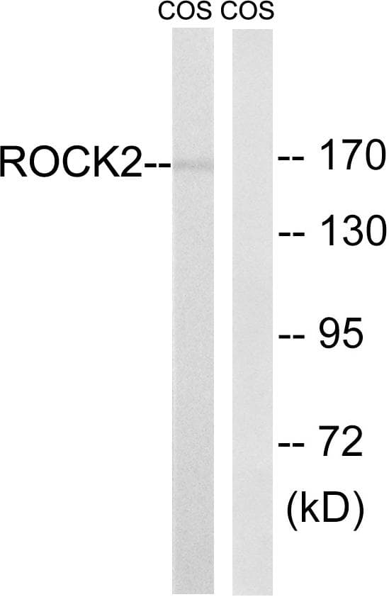 ROCK2 Antibody (p722)
