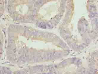 Polyclonal Rabbit anti-Human CLGN / Calmegin Antibody (IHC, WB)
