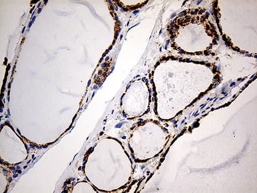 LAMP1 / CD107a Antibody (aa29-382, clone OTI8B1)