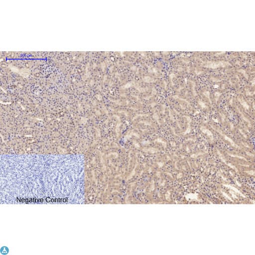 Polyclonal Rabbit anti-Human APP / Beta Amyloid Precursor Antibody (WB)