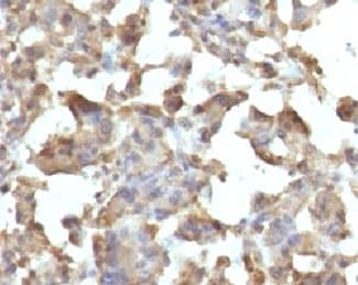 TNF Alpha Antibody (clone TMDa1-1)