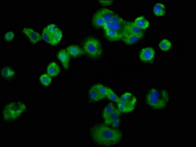 LSR / LISCH7 Antibody