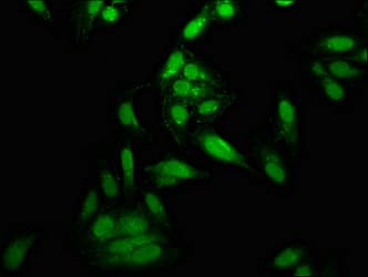 TOP1 / Topoisomerase I Antibody