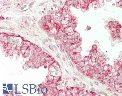 IHC-plus™ Polyclonal Rabbit anti-Human MAOA / Monoamine Oxidase Antibody (IHC, WB)