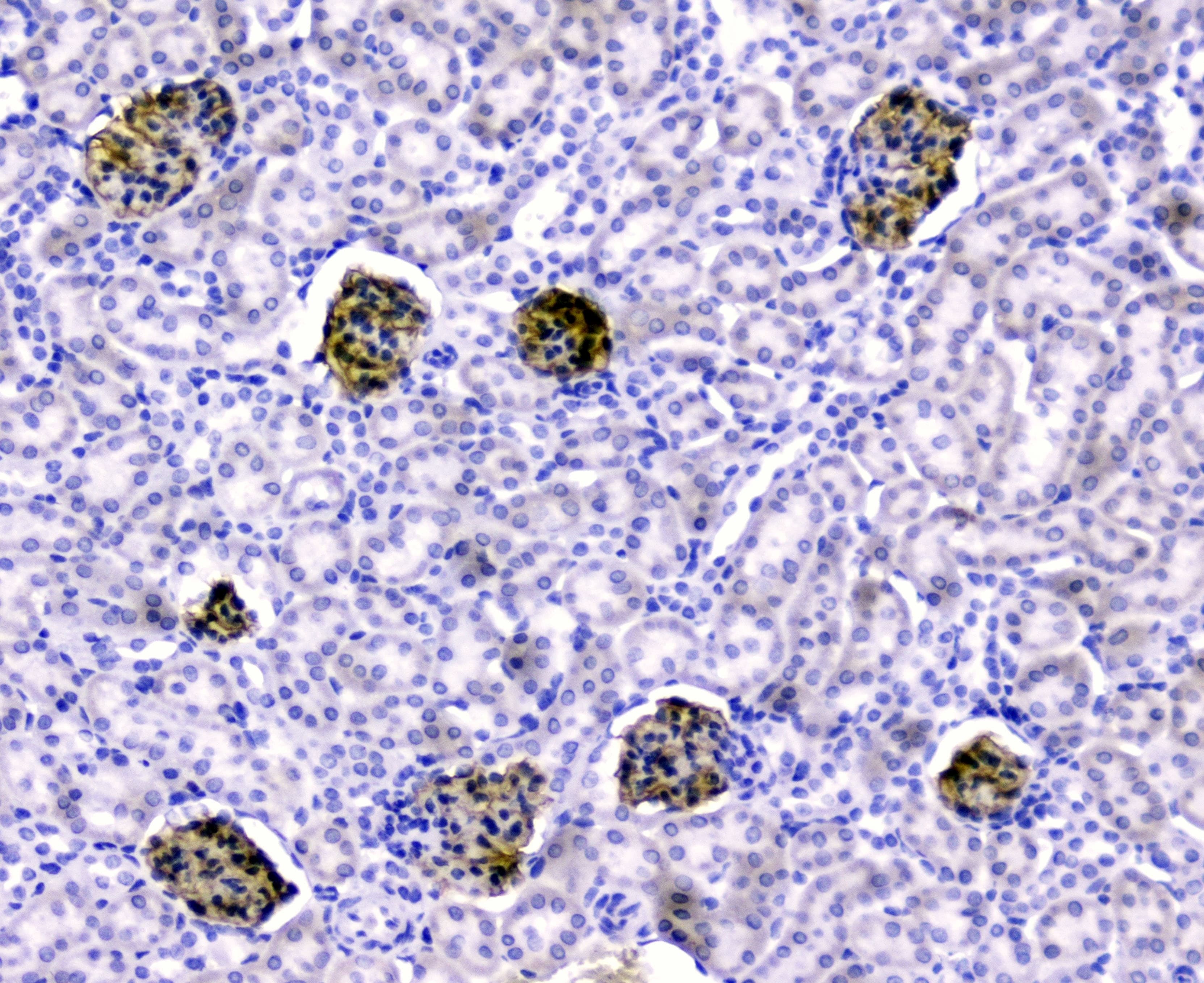 NPHS1 / Nephrin Antibody