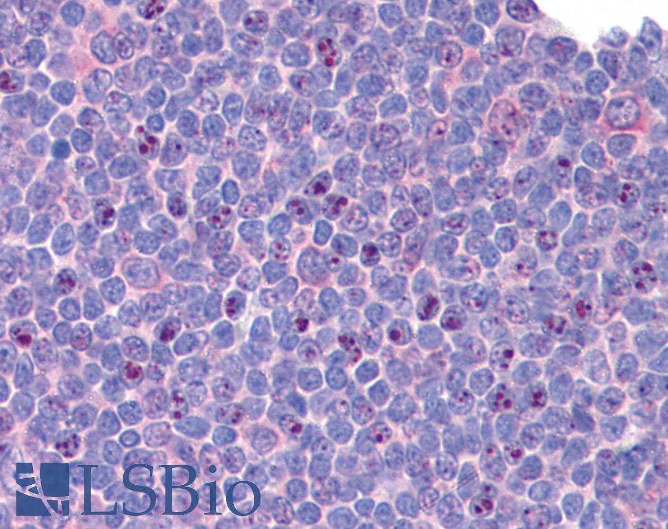 IHC-plus™ Polyclonal Rabbit anti-Human SIP1 Antibody (IHC, IF, WB)