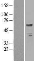Human BTD / Biotinidase Protein (Over-Expression Lysate Myc-DDK (Flag))