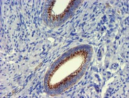 GOLM1 / GP73 / GOLPH2 Antibody (clone OTI2F3)