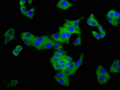 CSMD3 Antibody
