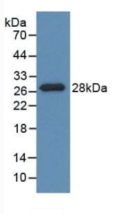 PDXK / PNK Antibody (aa35-251)