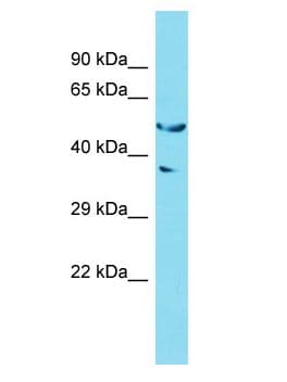 GOLGA6L2 Antibody (aa72-121)
