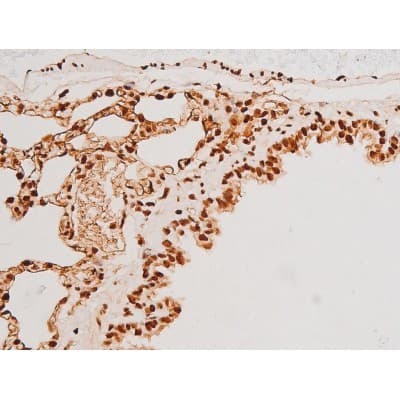 Polyclonal Rabbit anti-Human SYK Antibody (phospho-Tyr348, IHC, IF, WB)