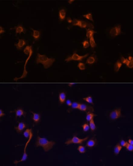 IHC-plus™ ABL1 / c-ABL Antibody