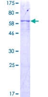 Human UGCG Protein (Recombinant GST)