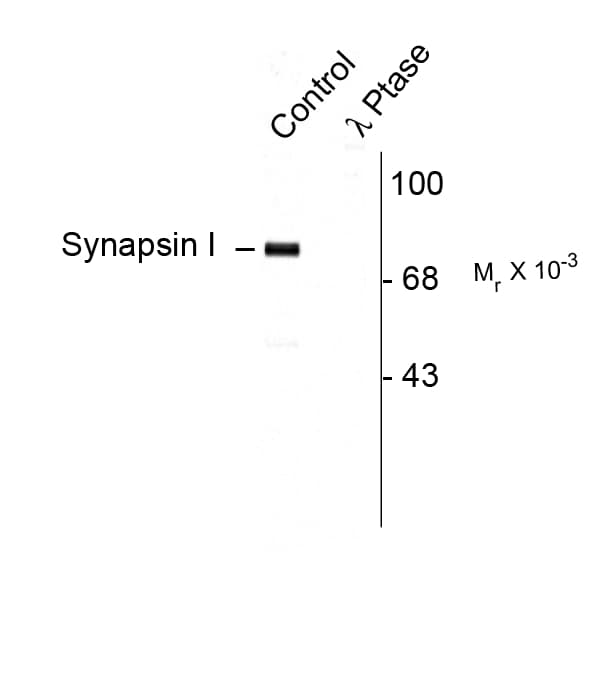 SYN1 / Synapsin 1 Antibody (phospho-Ser9)