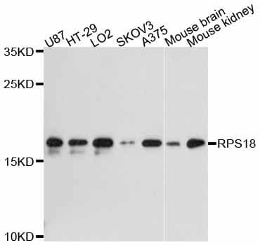 Polyclonal Rabbit anti-Human RPS18 / Ribosomal Protein S18 Antibody (WB)