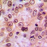 LIMK1 + LIMK2 Antibody (phospho-Thr508/Thr505)