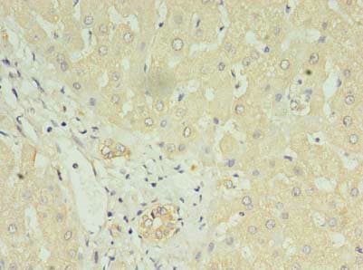 LYRM1 Antibody