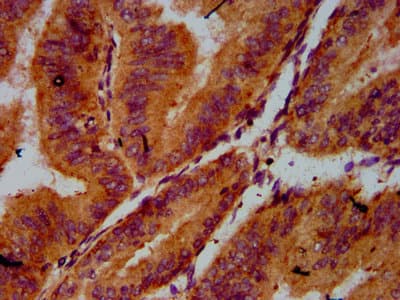 Polyclonal Rabbit anti-Human CDC123 Antibody (IHC)