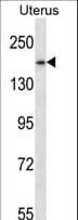 SMC1B Antibody (aa737-765)