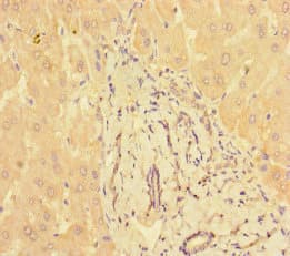 PPM1H Antibody