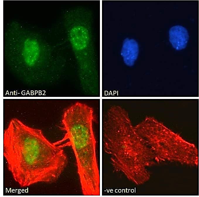 IHC-plus™ Polyclonal Goat anti-Human GABPB1 Antibody (aa198-210, IHC, IF, WB)