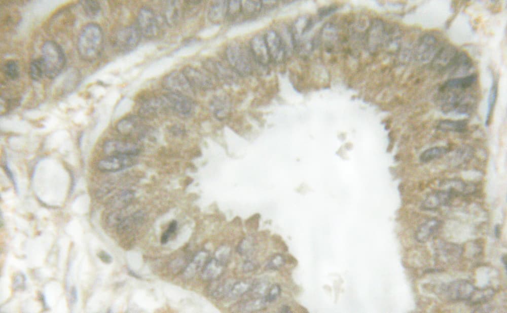 Polyclonal Rabbit anti-Human LIPE / HSL Antibody (phospho-Ser855,phospho-Ser554, IHC, IF, WB)