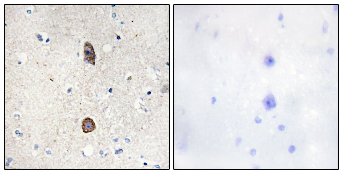 IGFBP3 Antibody (phospho-Ser183)