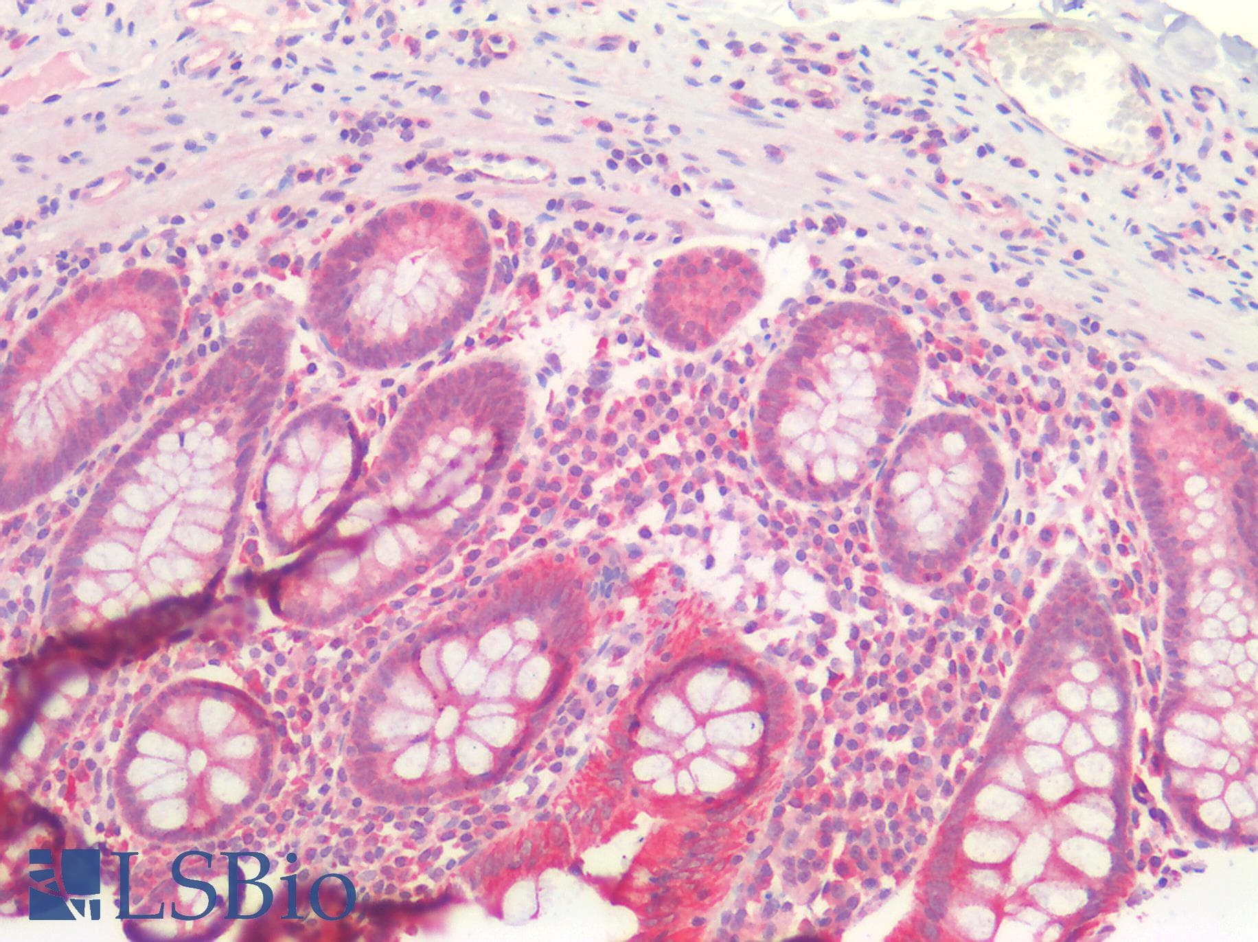IHC-plus™ NRAS / N-ras Antibody