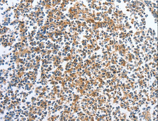 CKAP2 Antibody