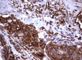 CD30 Antibody (clone OTI16H5)