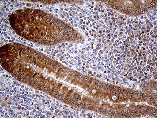 PRDX5 / Peroxiredoxin 5 Antibody (clone OTI3B6)