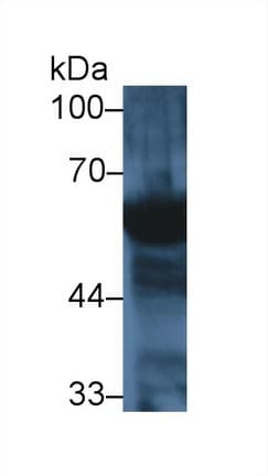 AMY2A / Pancreatic Amylase Antibody (aa22-257)