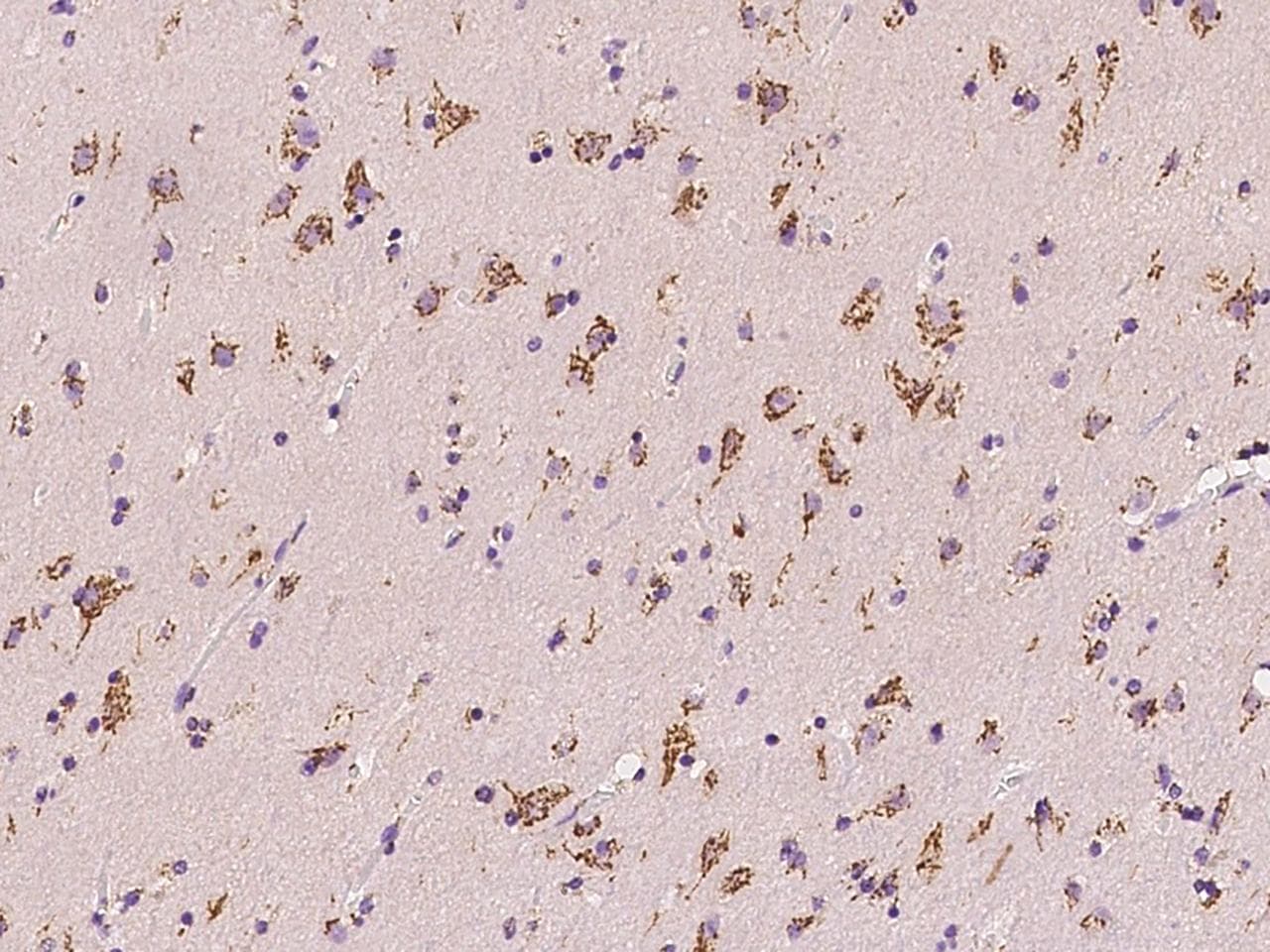 TM9SF3 Antibody