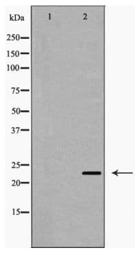IPP2 / PPP1R2 Antibody