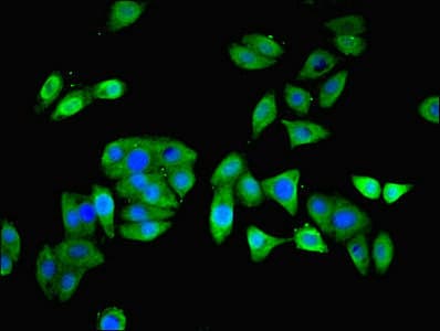IHC-plus™ Polyclonal Rabbit anti-Human PFDN5 / MM1 Antibody (IHC, WB)