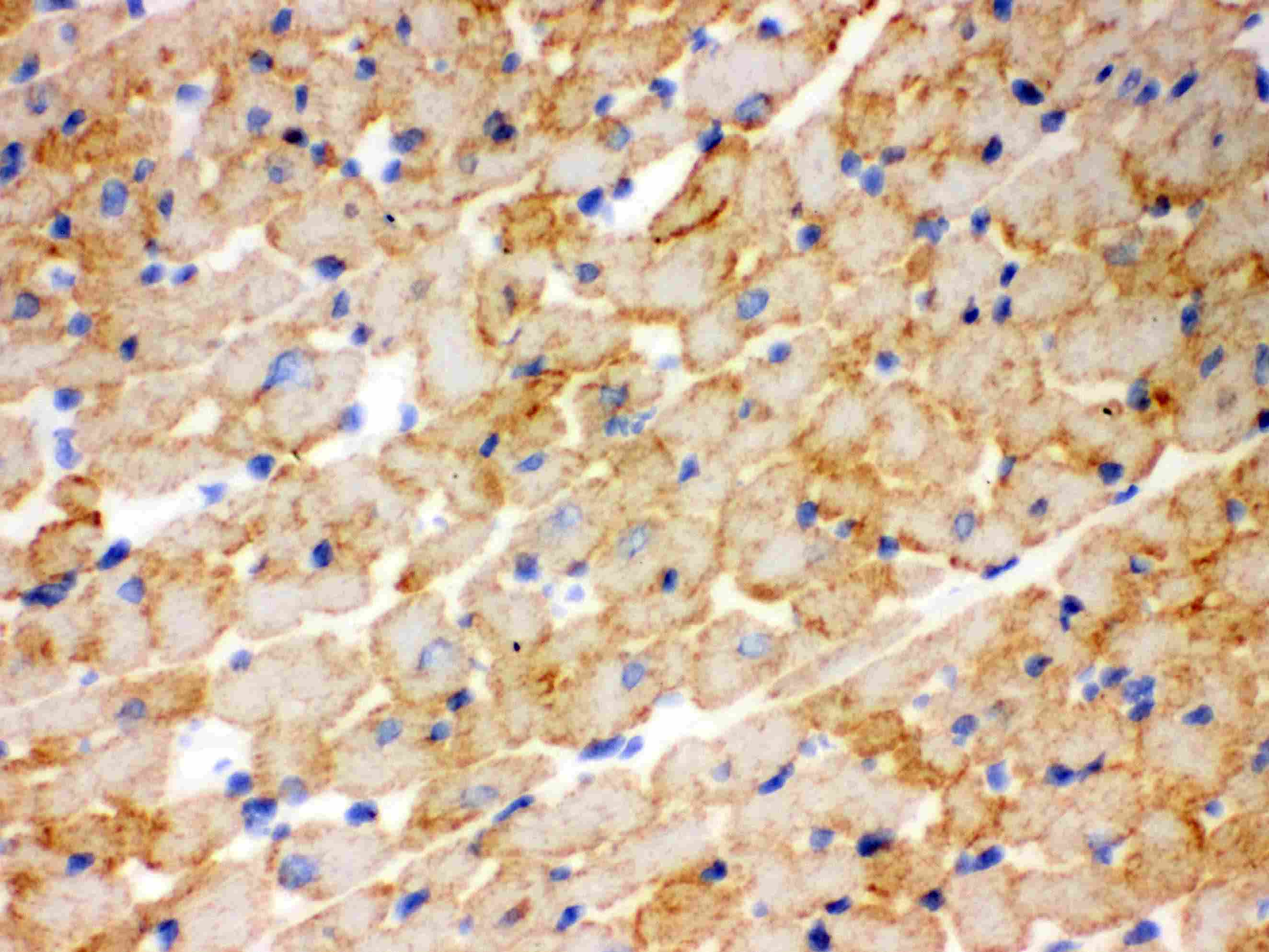 CPT1B Antibody (aa197-226)
