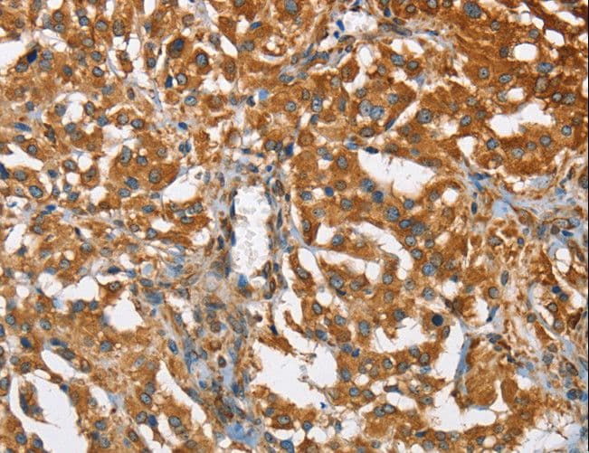 BCAP31 / BAP31 Antibody