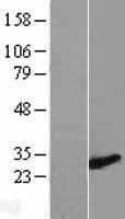 ZMYND19 Protein (Over-Expression Lysate Myc-DDK (Flag))