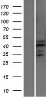 ATXN7L2 Protein (Over-Expression Lysate Myc-DDK (Flag))
