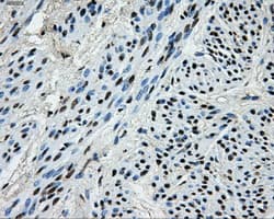 PKMYT1 Antibody (clone OTI5E1)