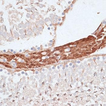 HSET / KIFC1 Antibody