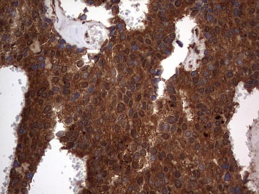 H2AFY2 Antibody (aa2-261, clone OTI1C2)