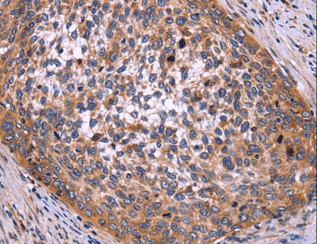 Polyclonal Rabbit anti-Human LCA3 / SPATA7 Antibody (IHC)